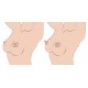 Nipple Teaser